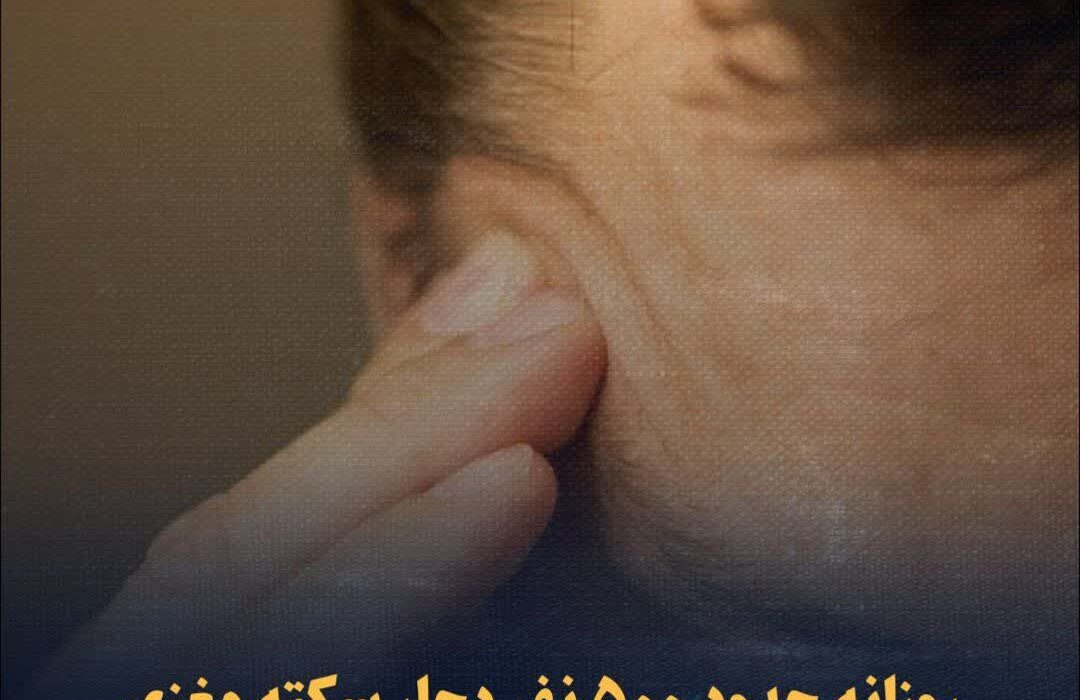 روزانه حدود ۵۰۰ نفر دچار سکته مغزی می‌شوند